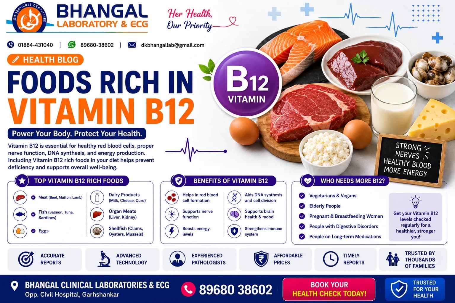 Foods Rich in Vitamin B12